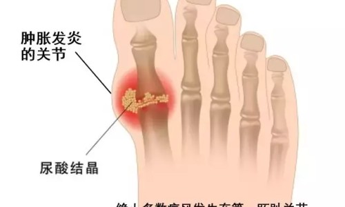 红胎记激光视频全过程-红胎记激光有效果吗网- 红胎记激光有效果吗知识,分享激光治疗红胎记有副作用吗